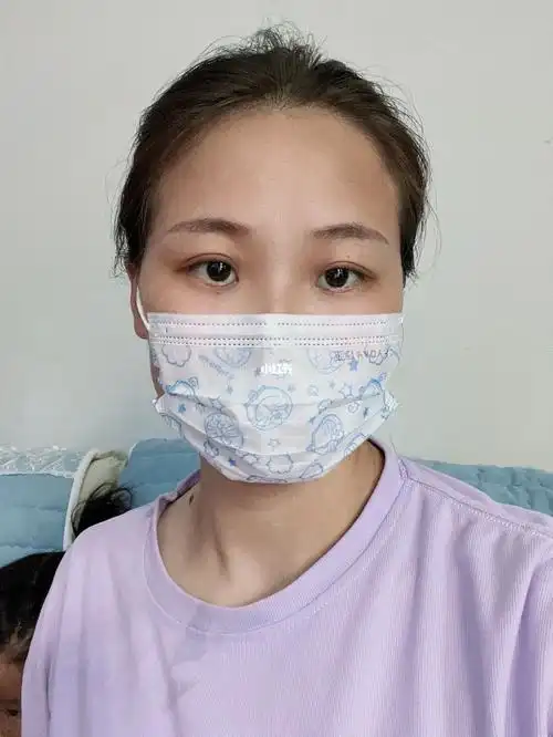 500度近视杭州近视手术分享