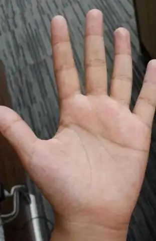 男人左手断掌会怎么样对于男人来讲,左为阳,左掌代表先天,男人左手