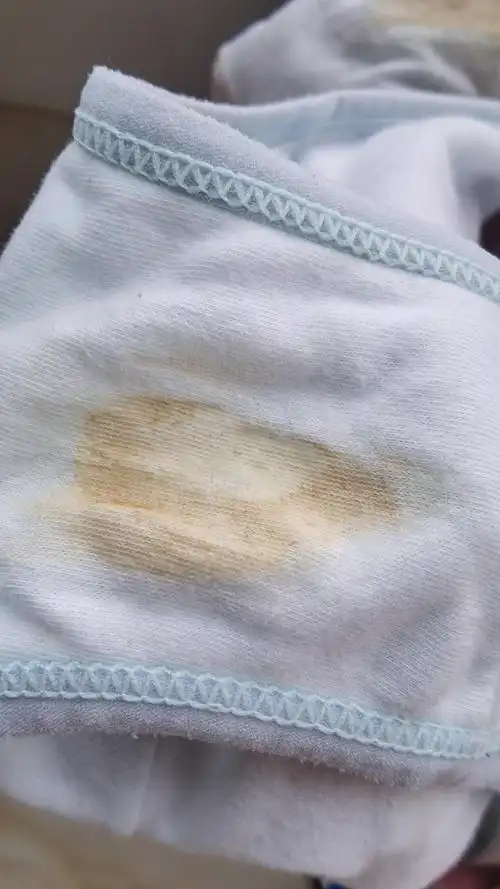 孕5周4天,内裤这两天这个颜色正常吗,姐妹们你们也有这种情况吗