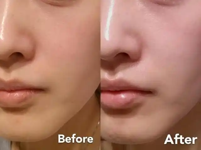 凝胶软膜和面膜对皮肤管理的优缺点对比