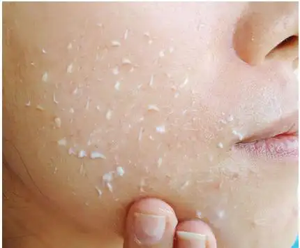 女人每周要做一次去角质?