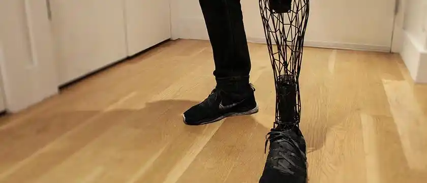 从而会影响到患者穿戴假肢的效果