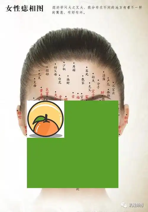 嘴角长痣的女人好不好 女人嘴巴上长痣好不好