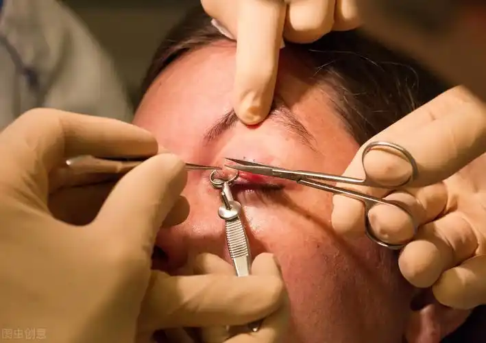 现代医学对于初期麦粒肿是没有什么有效治疗方法的,顶多开个眼药水滴