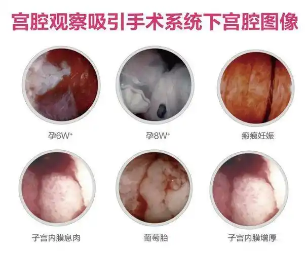 女性护"宫"法则,科学呵护子宫健康