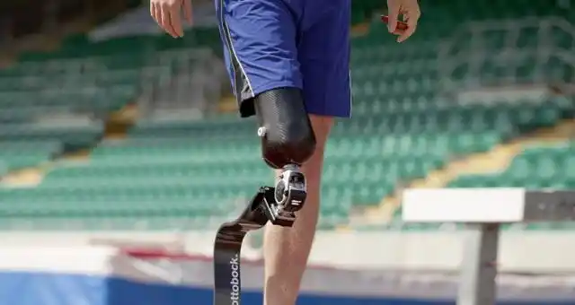 假肢脚的几种常见类型介绍