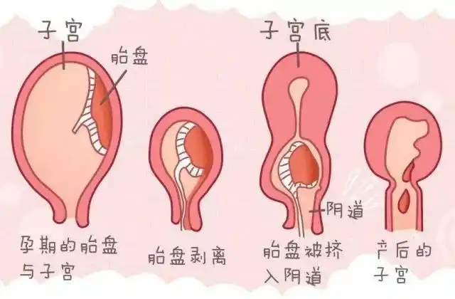 产妇生完孩子,子宫恢复期会有恶露排出,促进子宫恢复这么做