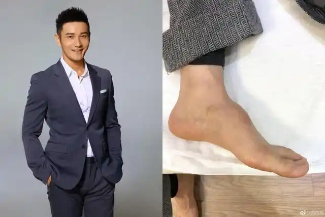 黄晓明晒高脚背破穿内增高谣言这些年他被诬陷得好可怜