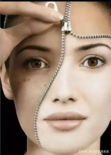 激光美白的坑,你掉过几个?别再浪费钱了!