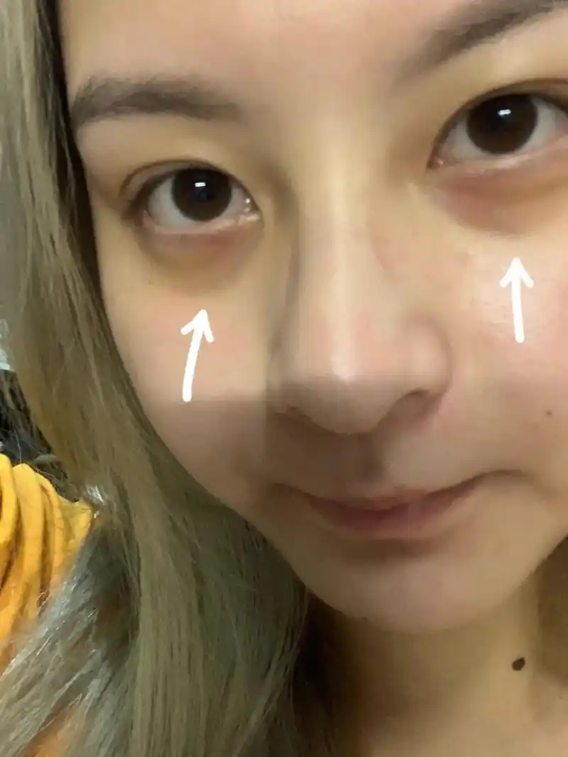 啊啊功课没白做低成本去黑眼圈get了