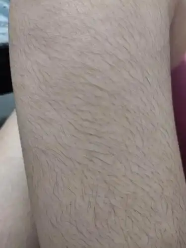 我女的汗毛有4cm长