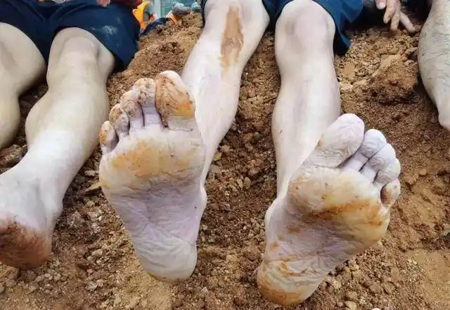 这双起皱发白的脚