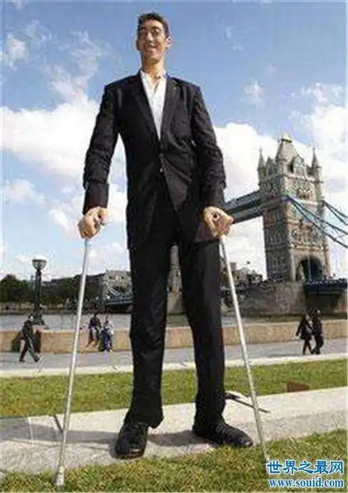 历史上世界上最高的人,罗伯特·潘兴·瓦德罗高达2.72米!