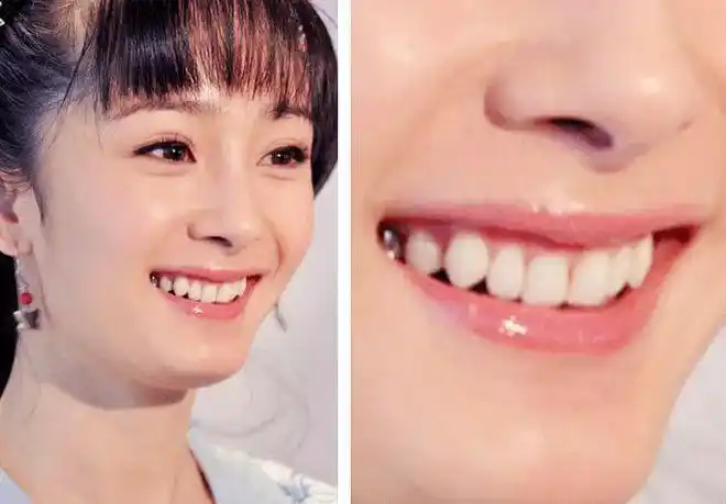 漂亮又杀出一个神颜小花勾走了国民老公威胁到了杨幂