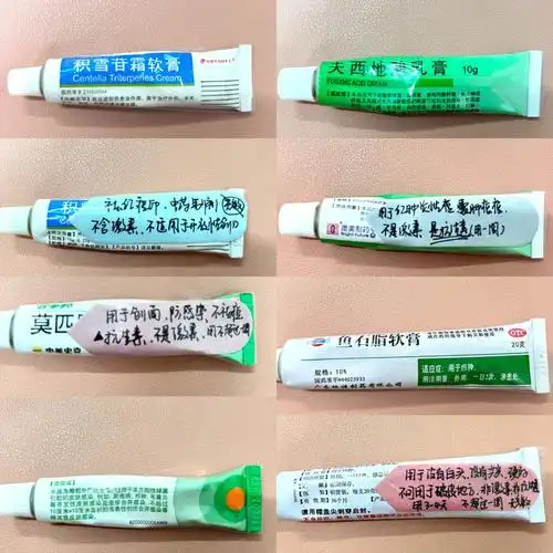 抗痘 | 这些软膏你不能错过