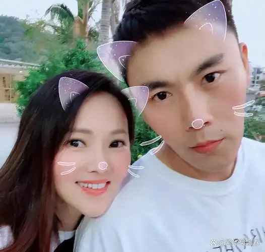 秦昊老婆跑韩国打水光针,56岁伊能静满脸针眼,感慨:真的很痛