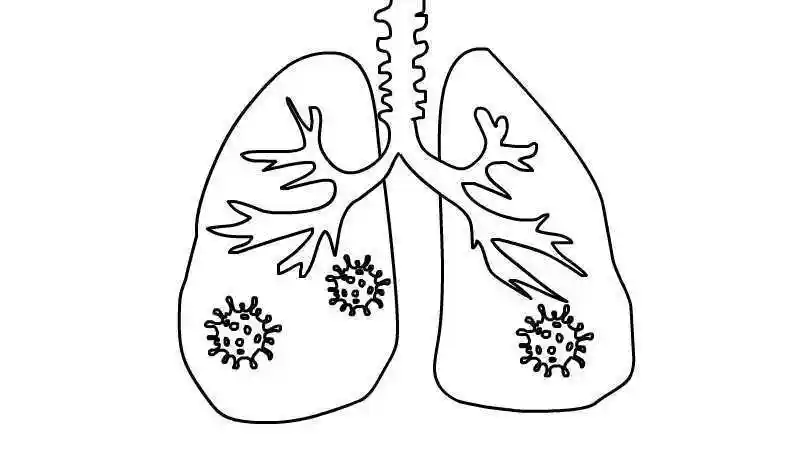 肺炎病毒简笔画