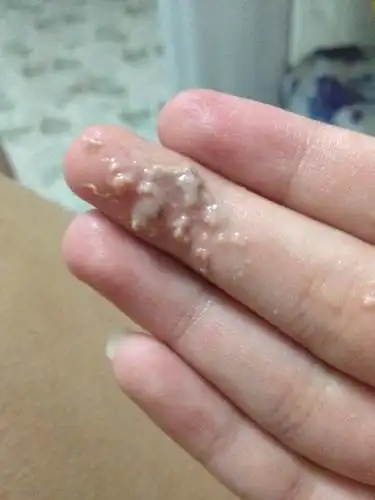 鱼腥味 去医院检查过白带