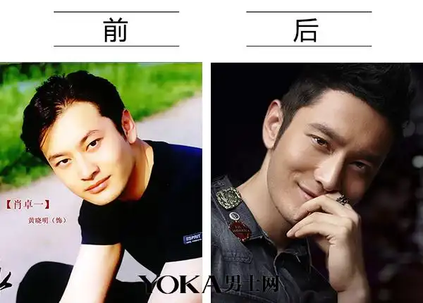 晓明和baby整容前照片