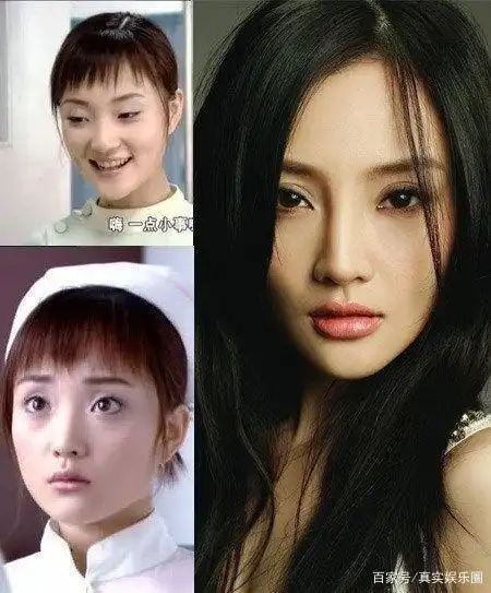 网传李小璐整容对比图