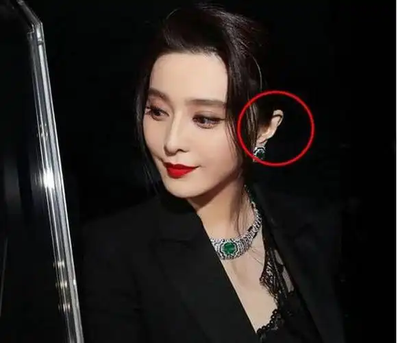 看起来耳骨微微外翻,显得很大.