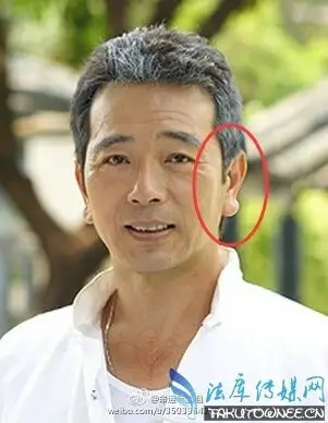 张晨光的耳朵耳垂太大了,为什么说耳垂大的人有福?