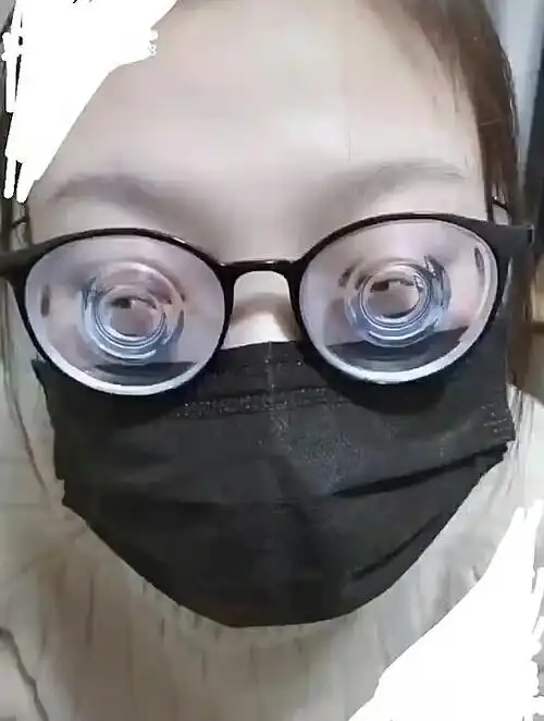 近视1000度什么样  这姑娘7000度