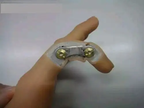 求助,美容假肢手掌去哪装比较好