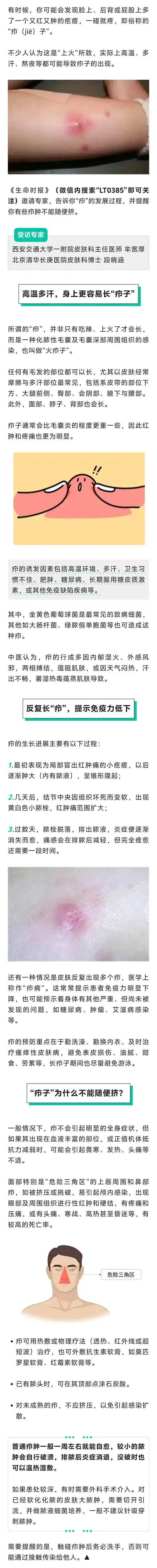"长疖子"是上火了吗?