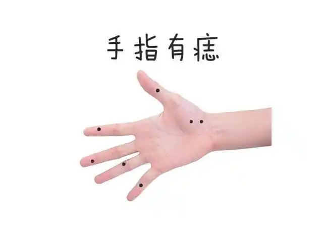 若为女性手指有痣,那么定能嫁得好丈夫,能够招财旺夫;若为男性手指有