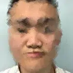 binder综合征是颅颌面外科的常见疾病,其发病机理目前还不是十分清楚.