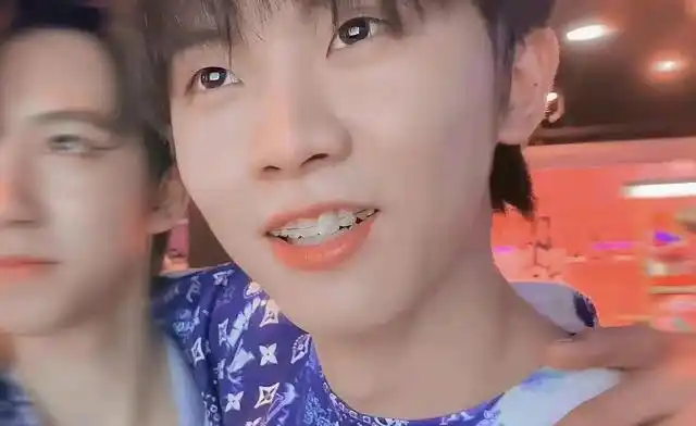 马嘉祺虎牙没了!牙套戴半年,限定"小钢牙"军训后摘掉