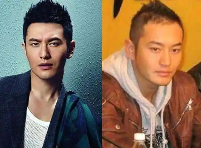 的头发又突然浓密,但后枕部却稀稀拉拉的原因,不过雍禾(植发)想要问问