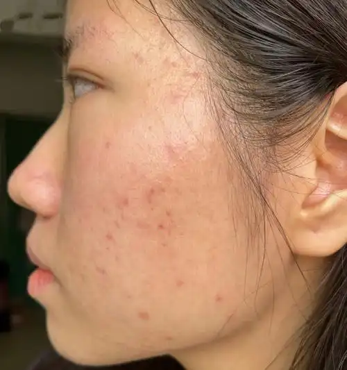 熬夜,压力大皮肤暗沉出油不光,选的面霜没护肤效果还搓泥?