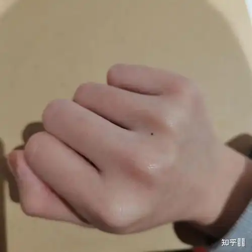 女生右手中指突然长了个小痣代表什麼? - 知乎
