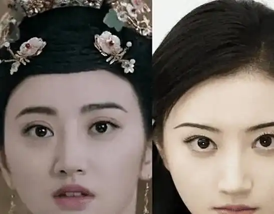 才知眼皮不能跟风割,一刀把灵气都割飞了|戚薇|景甜|整容|双眼皮手术