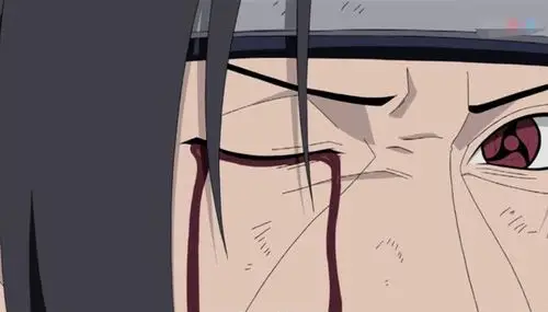 火影忍者:为什么只有在使用天照的时候,万花筒写轮眼会流血呢?|宇智波