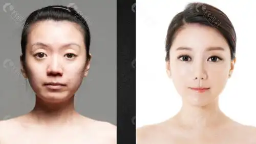 长脸适合什么样的双眼皮? - 爱美容研社