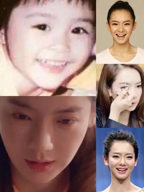 戚薇爆粗回应双眼皮贴网友纷纷晒出割双眼皮价格这也是醉了