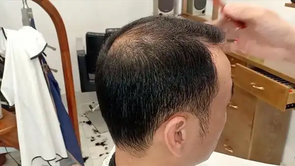 男人头发稀少发型这样剪,清爽利落,很实用
