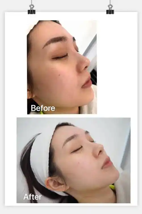 奚梦瑶_clear_治疗