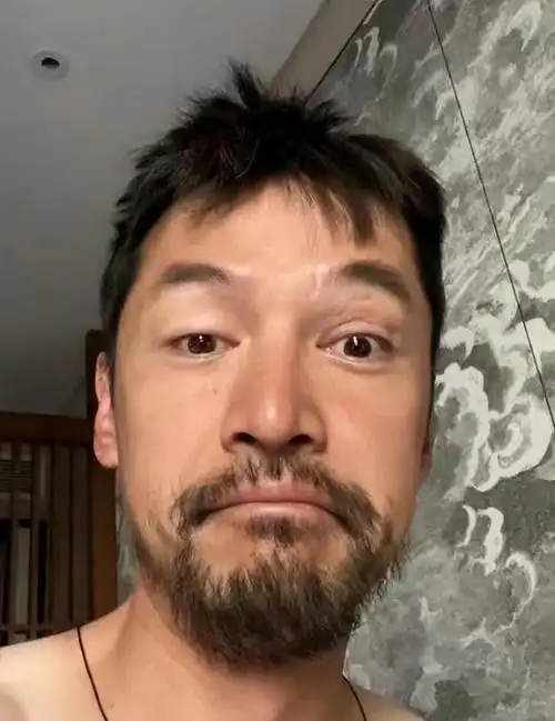 胡歌精神现状惹担忧!凌晨晒照满脸胡须露车祸伤疤,发文情绪低落