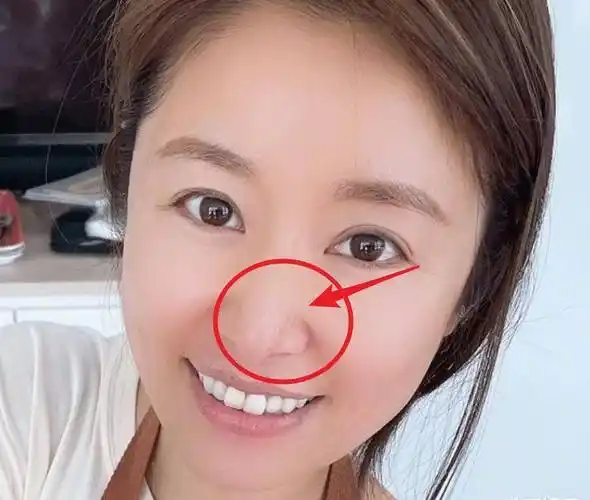 虽然整体上看林心如的皮肤状态很不错,但是放大照片之后,鼻子上的细节