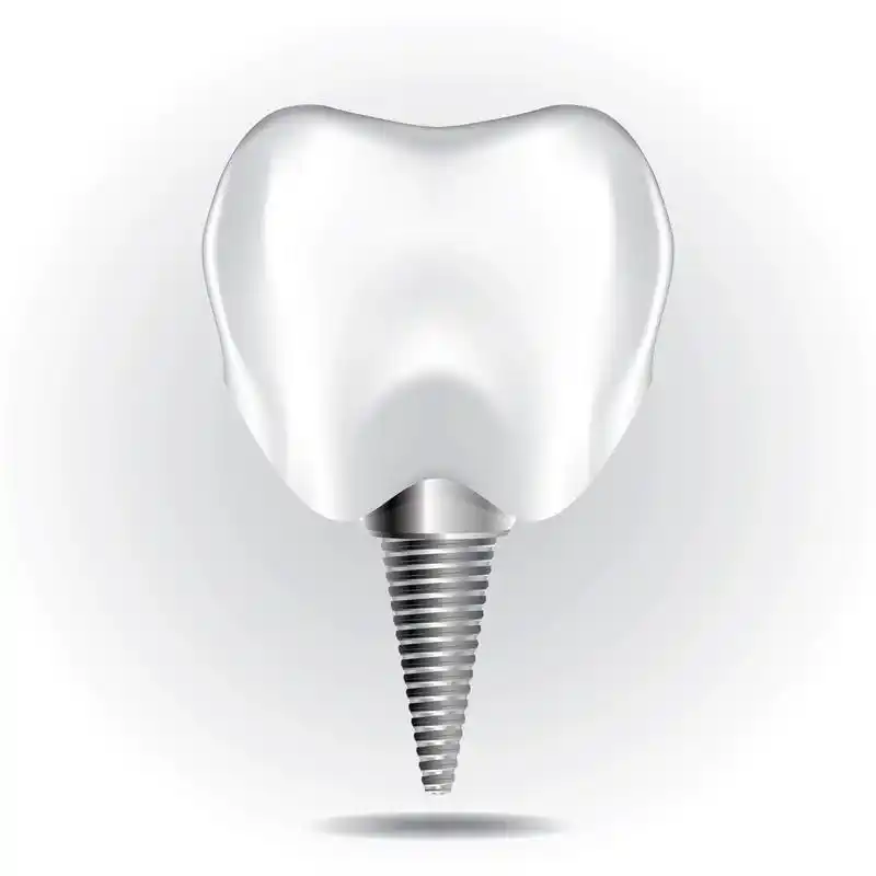 牙种植体设置 1,在白色背景牙种植体上绘图