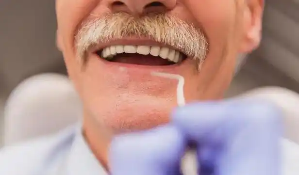 长沙老年人适合做种植牙吗?术前术后有什么需要注意的?-名医汇