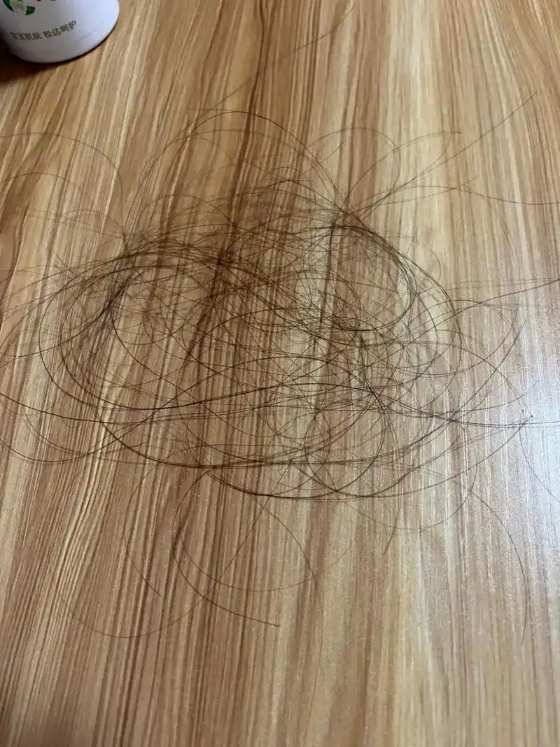 "三月儿认母,青丝铺满床"所到之处,皆是发. 产后脱发也许会 - 抖音