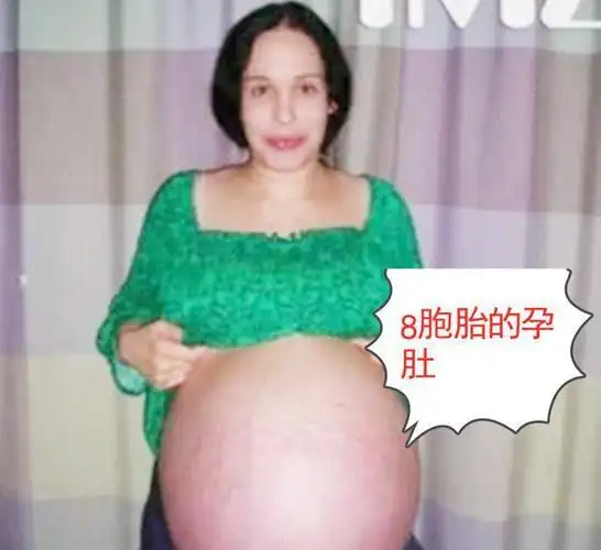 再生8胞胎,14个娃独自抚养压力巨大|多胞胎|妊娠|受孕|怀孕_网易订阅