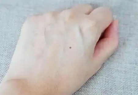 长痣代表什么痣相学对于手上的痣有一定的说法,即"手心主富,手背主贵"