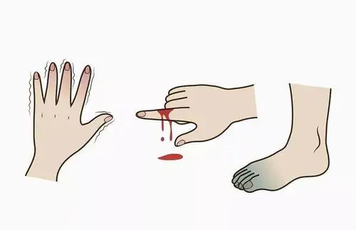 术后伤口难愈,长宁这家医院办法多效果好!