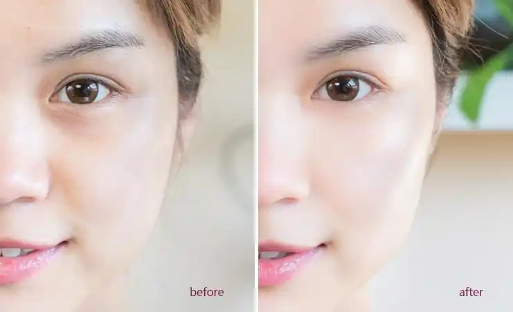 4周下来的对比图可以看到,皮肤肤色变均匀,整体白了一个色号吖!